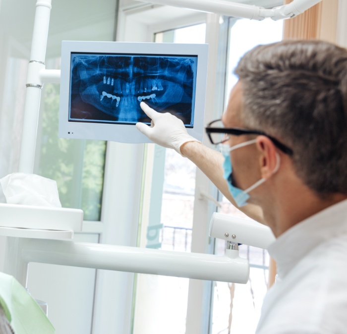 Dentist looking at digital x-rays on chairside computer