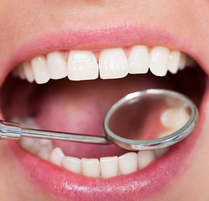 Mouth is examined with dental mirror