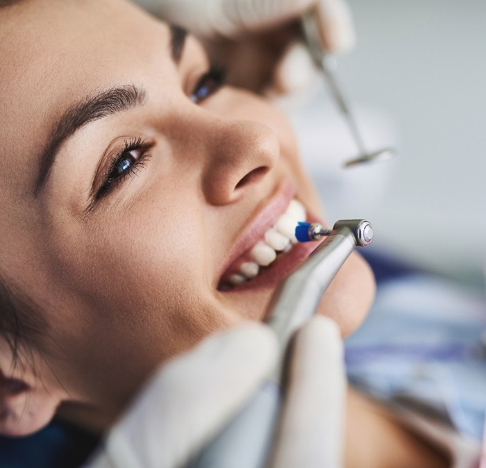 Closeup of woman smiling as gloved hands professionally polish her teeth