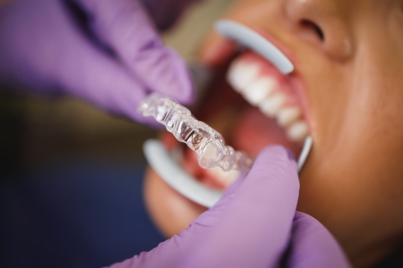 person beginning their Invisalign treatment process in Houston
