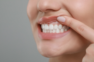 a patient with healthy teeth and gums